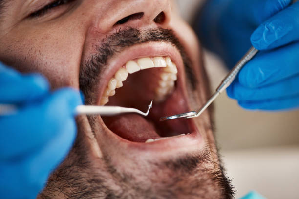 Best Broken or Cracked Tooth Emergency Dentist in Lindenhurst, NY